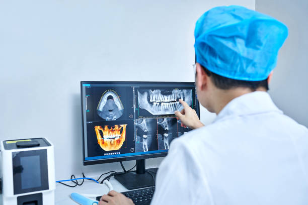 Best Emergency Wisdom Tooth Extraction in Lockland, OH